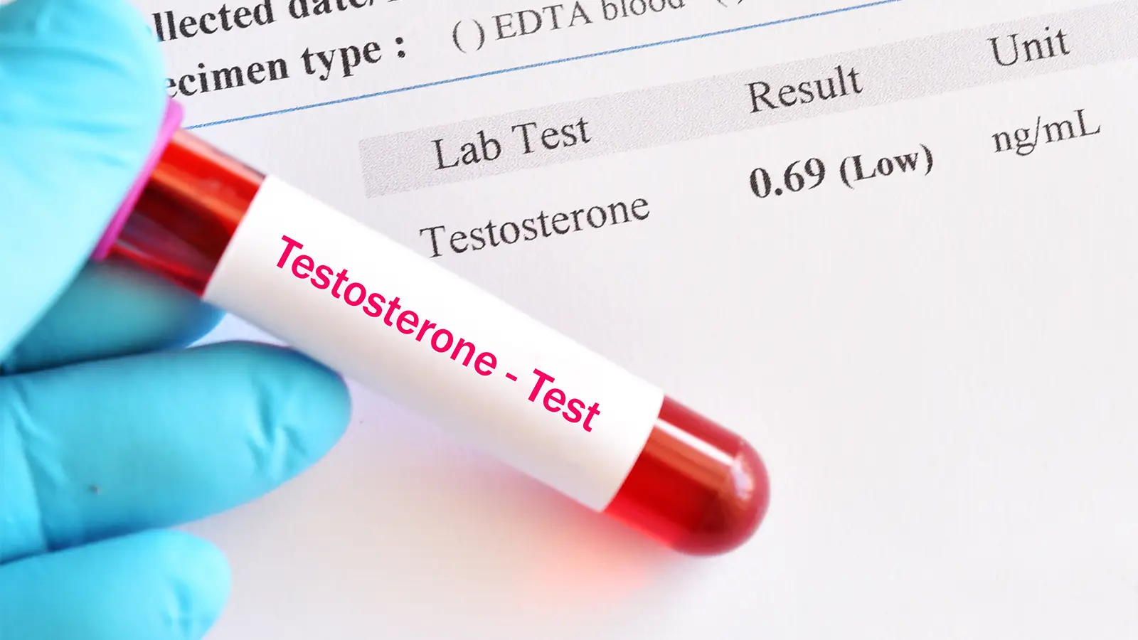 Testosterone Levels Investigating Men's Health   Private Medical ...